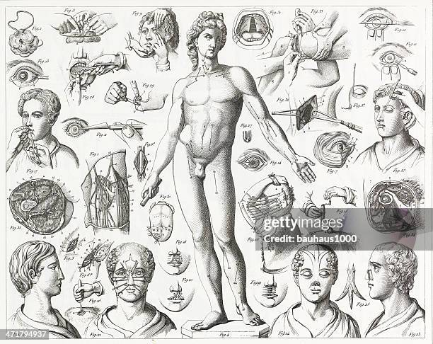 surgical operations engraving - diagram of the human body stock illustrations