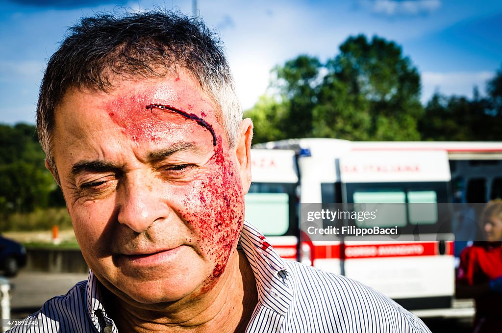 Man face after car accident