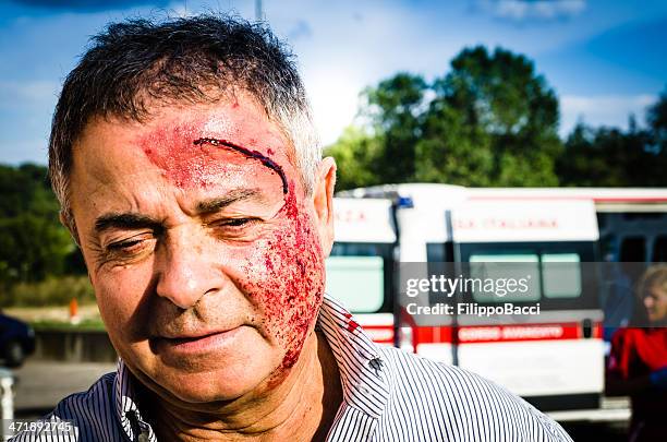 man face after car accident - gory car accident photos stock pictures, royalty-free photos & images