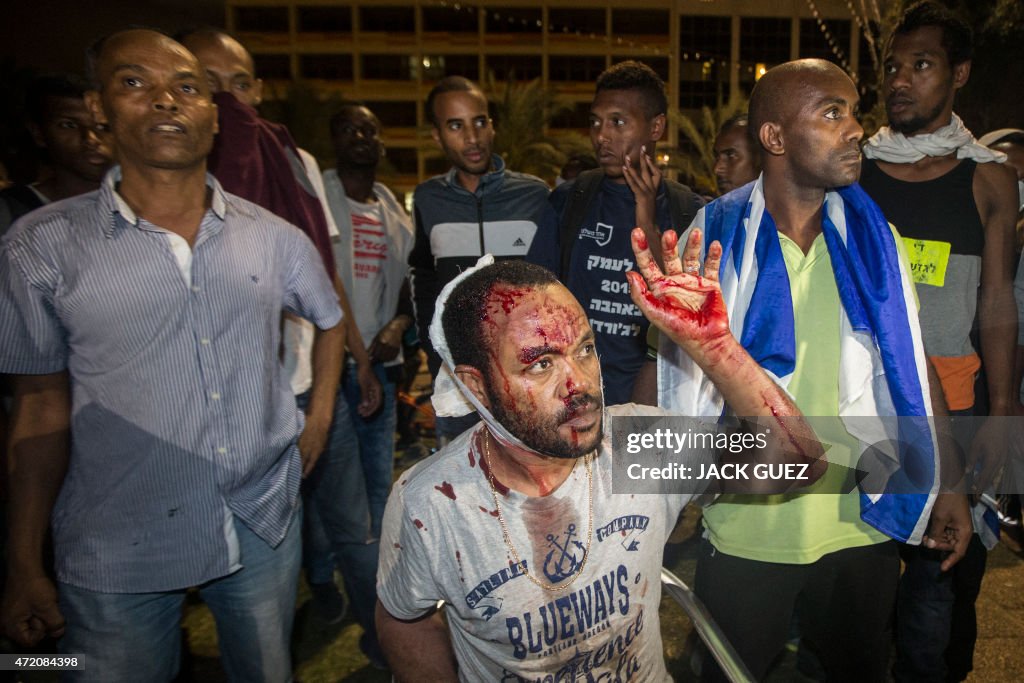 TOPSHOT-ISRAEL-ETHIOPIA-DEMONSTRATION