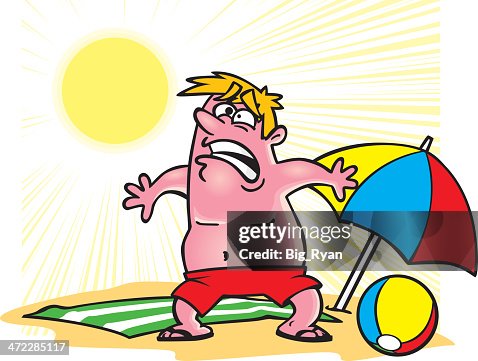 Sunburn Sunburn