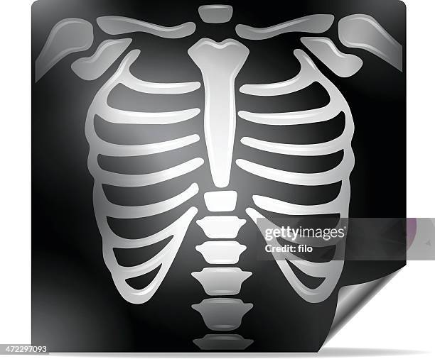 ilustraciones, imágenes clip art, dibujos animados e iconos de stock de x-ray - urgencias-hospital