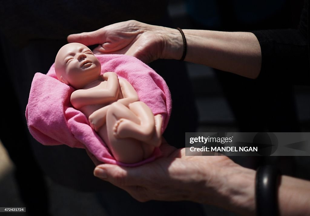 US-CONGRESS-ABORTION-PROTEST