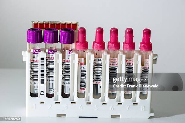 Many capillary tubes, filled with blood for diagnose the blood type, are sorted in a white rack.