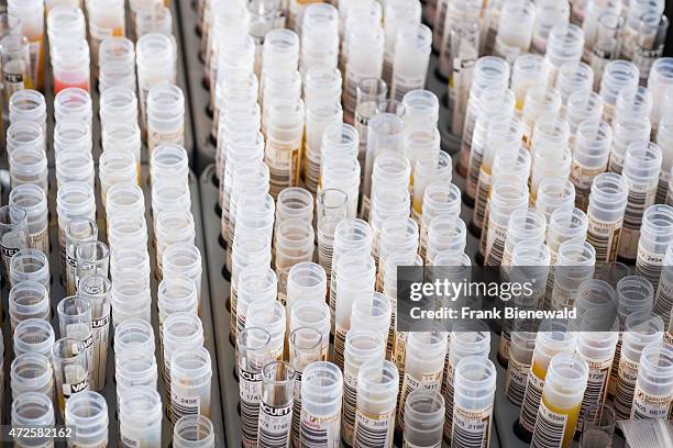 Examinated samples in transparent capillary tubes are sorted in grey racks.