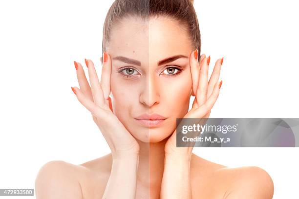 antes y después de - tipos de piel fotografías e imágenes de stock