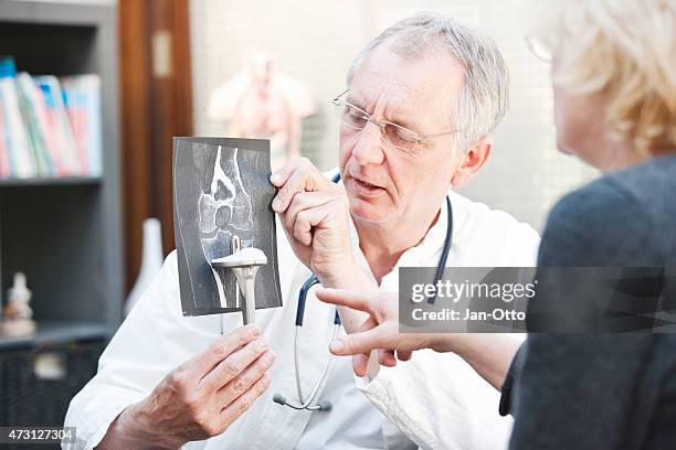 mature doctor presenting x-ray and knee arthroplasty to female patient - orthopedic surgeon stock pictures, royalty-free photos & images