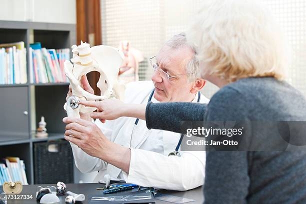 mature doctor presenting total hip arthroplasty to female patient - acetabulum stock pictures, royalty-free photos & images