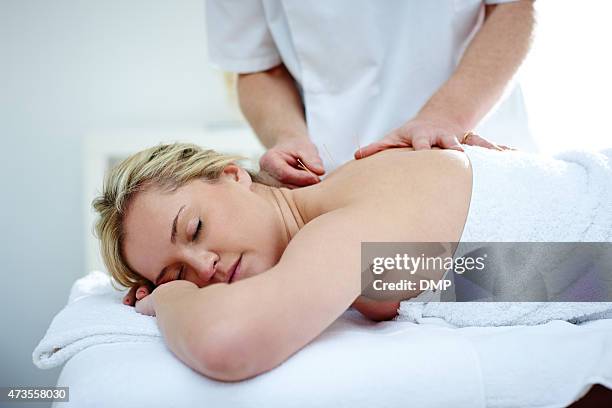 caucasian woman receiving an acupuncture treatment - acupuncture needle 個照片及圖片檔