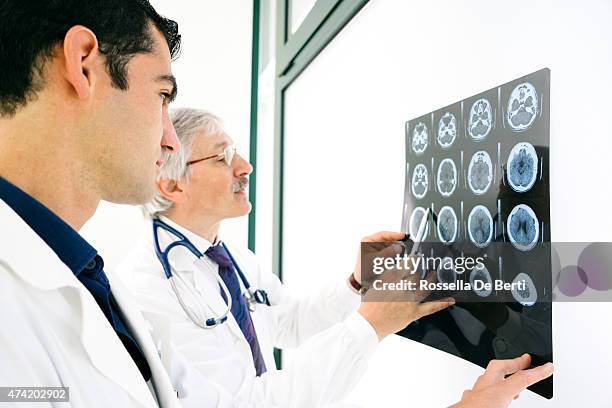 doctors consult over an mri scan of the brain - alzheimers brain stockfoto's en -beelden