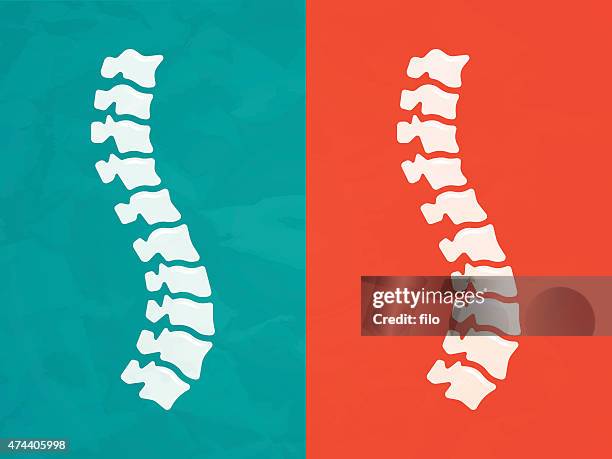 ilustraciones, imágenes clip art, dibujos animados e iconos de stock de la columna - escoliosis