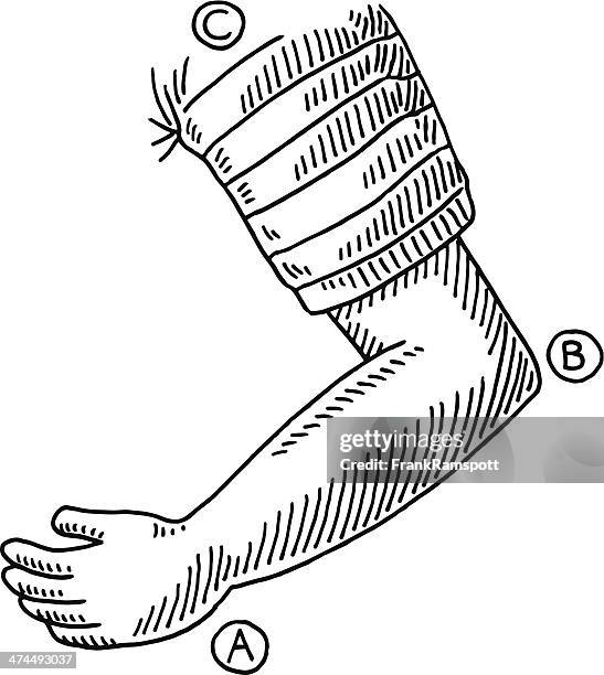 stockillustraties, clipart, cartoons en iconen met arm bent elbow drawing - verbogen