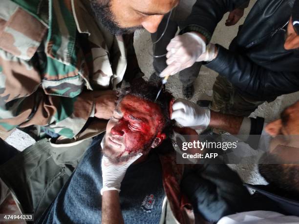 Rebel fighter injured during a battle against Syrian government forces receives medical treatment at a makeshift hospital in Khan Sheikhun, north of...