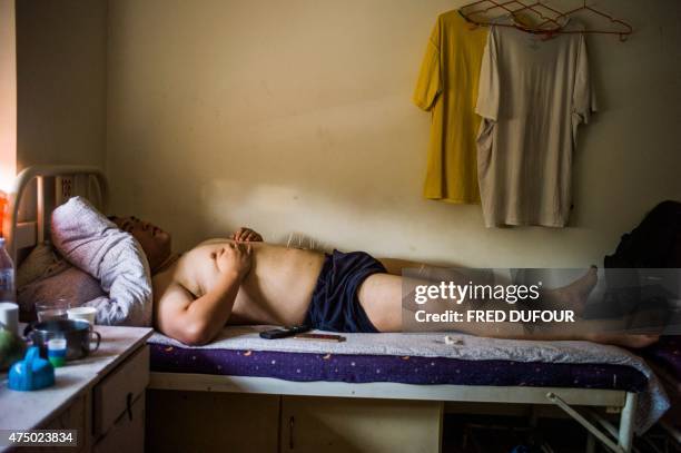 This picture taken on May 25, 2015 shows overweight boy having acupuncture treatment at the Aimin Fat Reduction Hospital in the northern port city of...