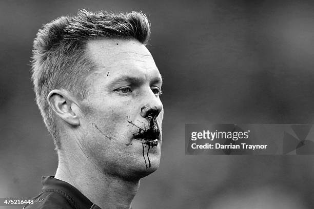 Sam Mitchell of the Hawks comes from the ground with blood flowing from his nose during the round nine AFL match between the Hawthorn Hawks and the...