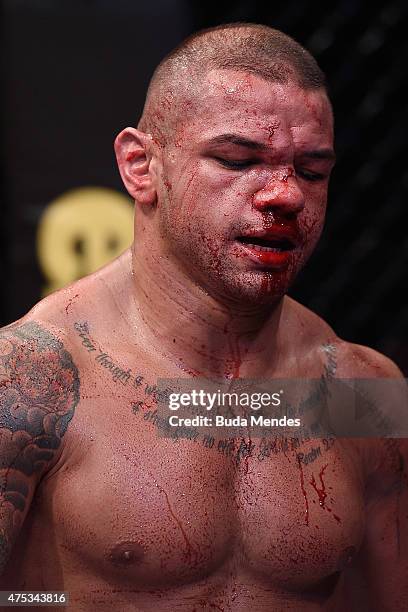 Thiago Alves of Brazil looks on after his welterweight UFC bout against Carlos Condit of the United States during the UFC Fight Night event at Arena...