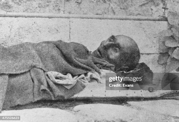 Greek civilian victim of the Great Famine, the period of mass starvation during the Axis occupation of Greece, World War II, 1942.