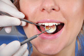woman visit to dentis