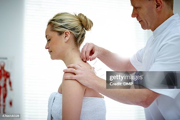 fisioterapista fare di agopuntura sulla schiena femmina paziente - agopuntura foto e immagini stock