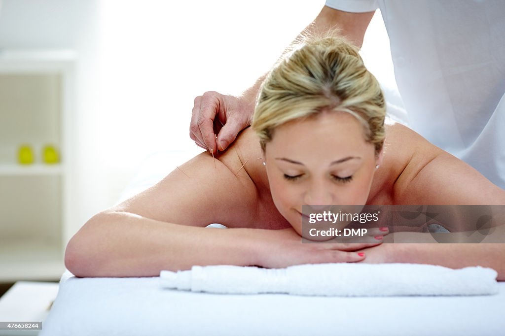 Acupunturista haciendo la acupuntura en el hombro de una mujer
