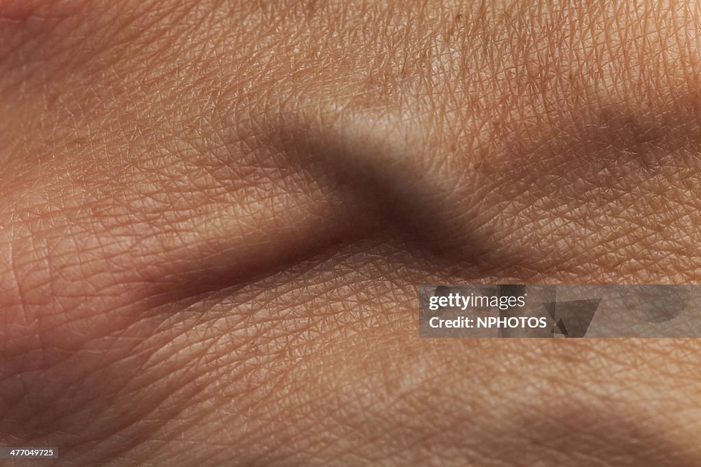 Hand vein