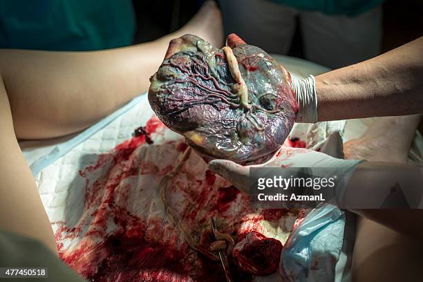 doctor showing placenta - umbilical cord stock pictures, royalty-free photos & images