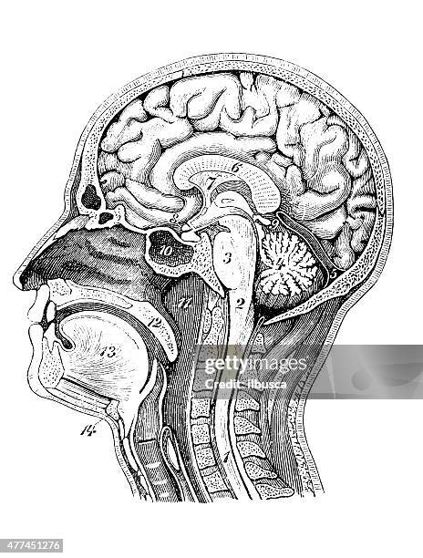 アンティークの医療科学イラストレーション高分解能: ヘッドのセクション - 脳外科手術点のイラスト素材／クリップアート素材／マンガ素材／アイコン素材