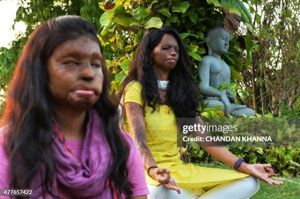 To go with story 'India-lifestyle-yoga-government' by Annie BANERJI In this photograph taken on June 14 Indian acid attack survivors, 20 year-old,...