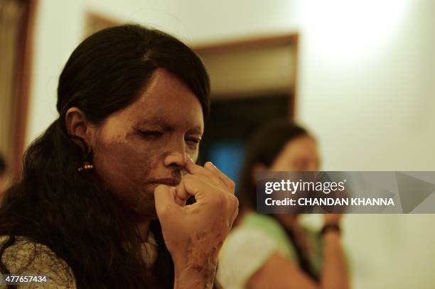 To go with story 'India-lifestyle-yoga-government' by Annie BANERJI In this photograph taken on June 14 26 year-old Indian acid attack survivor,...