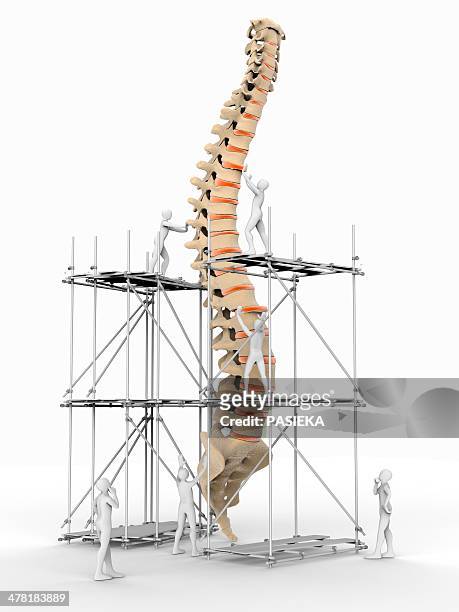 ilustrações de stock, clip art, desenhos animados e ícones de spine with workers, spine repair - osteoporose