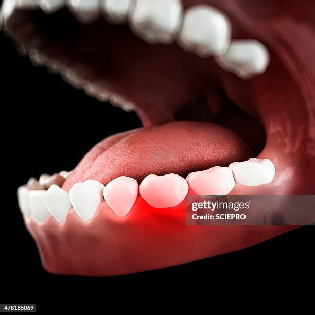 toothache, conceptual artwork - human teeth stock illustrations