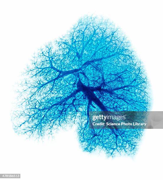 lung, x-ray - bronchialbaum stock-fotos und bilder