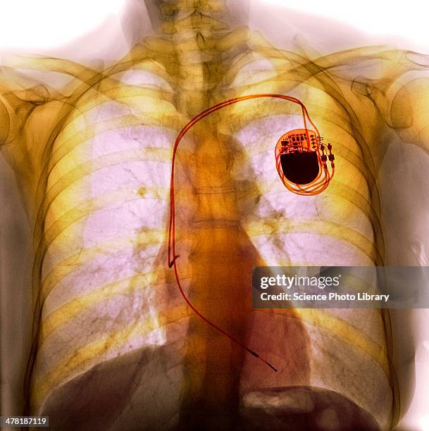 Dual Chamber Photos and Premium High Res Pictures - Getty Images