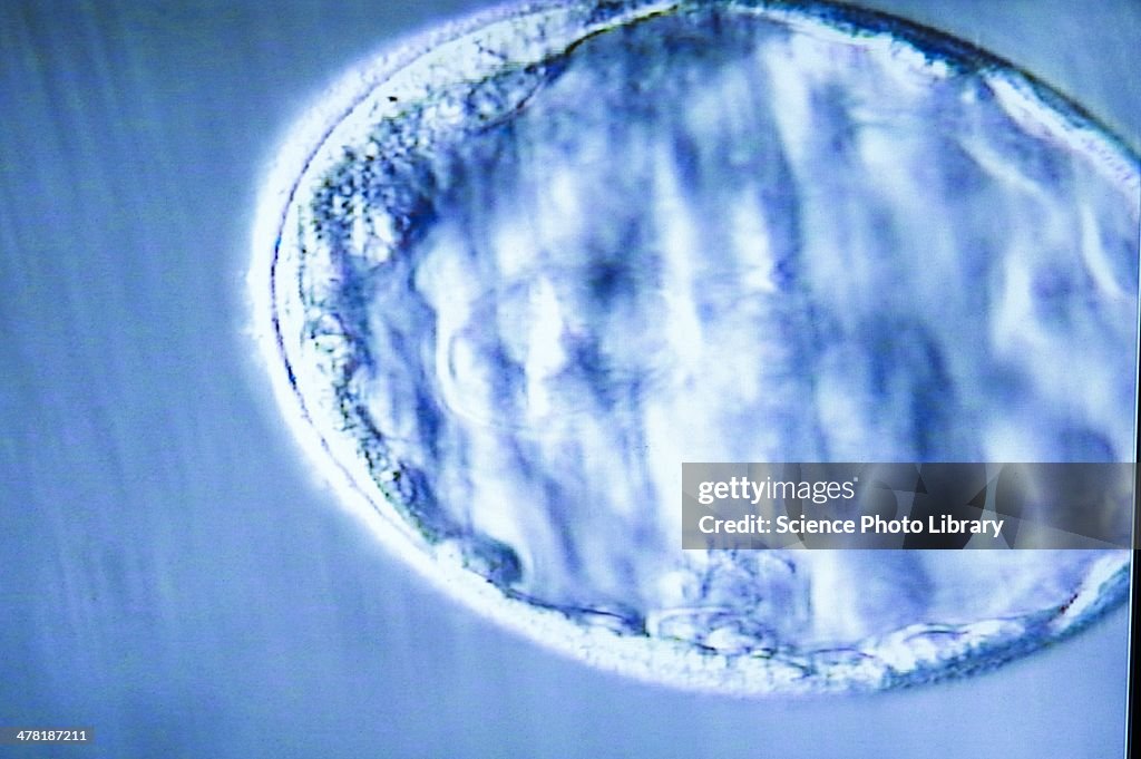Blastocyst embryo, light micrograph