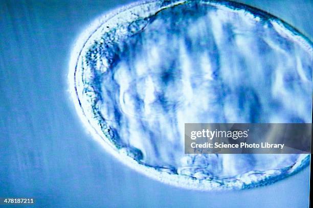 blastocyst embryo, light micrograph - mitosis 個照片及圖片檔