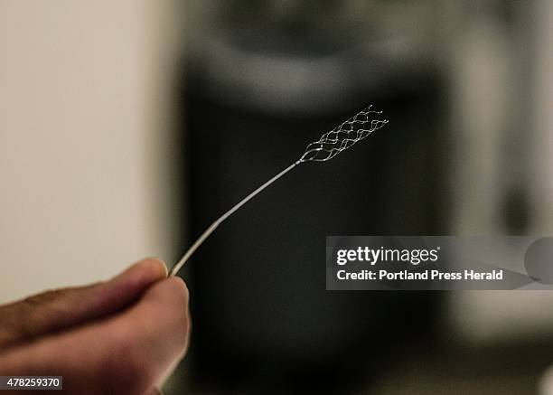 Doctor Robert Ecker holds a device called a stent retriever, which is used in groundbreaking new treatment for a major stroke by removing blood clots...