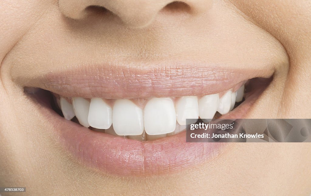 Female smiling, perfect teeth, close up