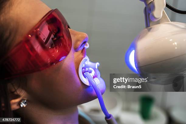 primo piano della luce ultravioletta procedura in ambulatorio dentistico. - sbiancamento dentale foto e immagini stock