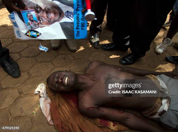 Supporter of Kizza Besigye lies waiting for medical assistance after he was shot by Ugandan police in Kampala, on July 1, 2015. The accident happened...