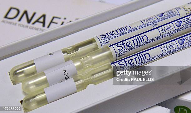 Swab testing kit is pictured in Manchester, north-west England, on March 17, 2014. AFP PHOTO/PAUL ELLIS