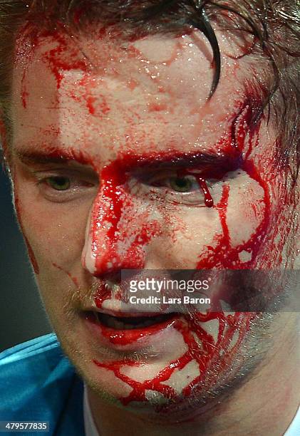 Tomas Hubocan of Zenit looks on as blood pours from a cut during the UEFA Champions League round of 16, second leg match between Borussia Dortmund...