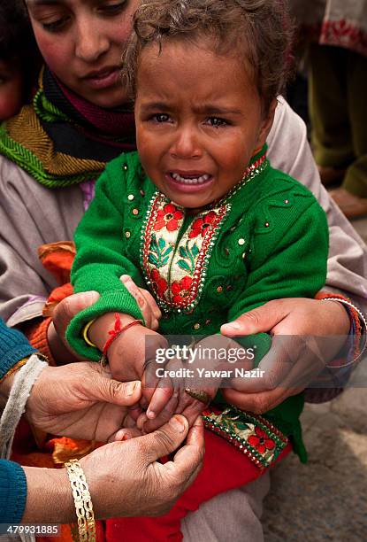 Young Kashmiri patient cries as she receives leech therapy on her hands on March 21 in Srinagar, the summer capital of Indian administered Kashmir,...