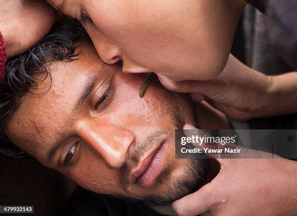 Practitioner blows hot air from his mouth on the leech as he gives leech therapy to a Kashmiri patient on March 21 in Srinagar, the summer capital of...