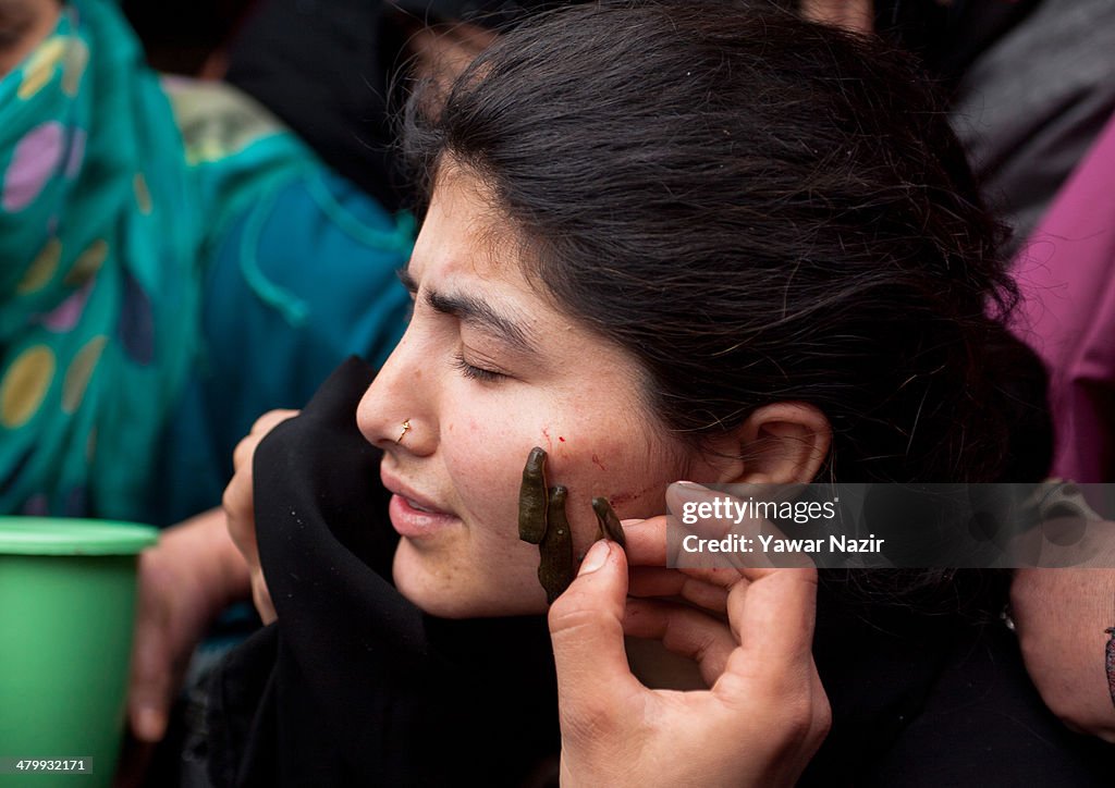 On Nowruz, Patients In Kashmir Go For Leech Therapy