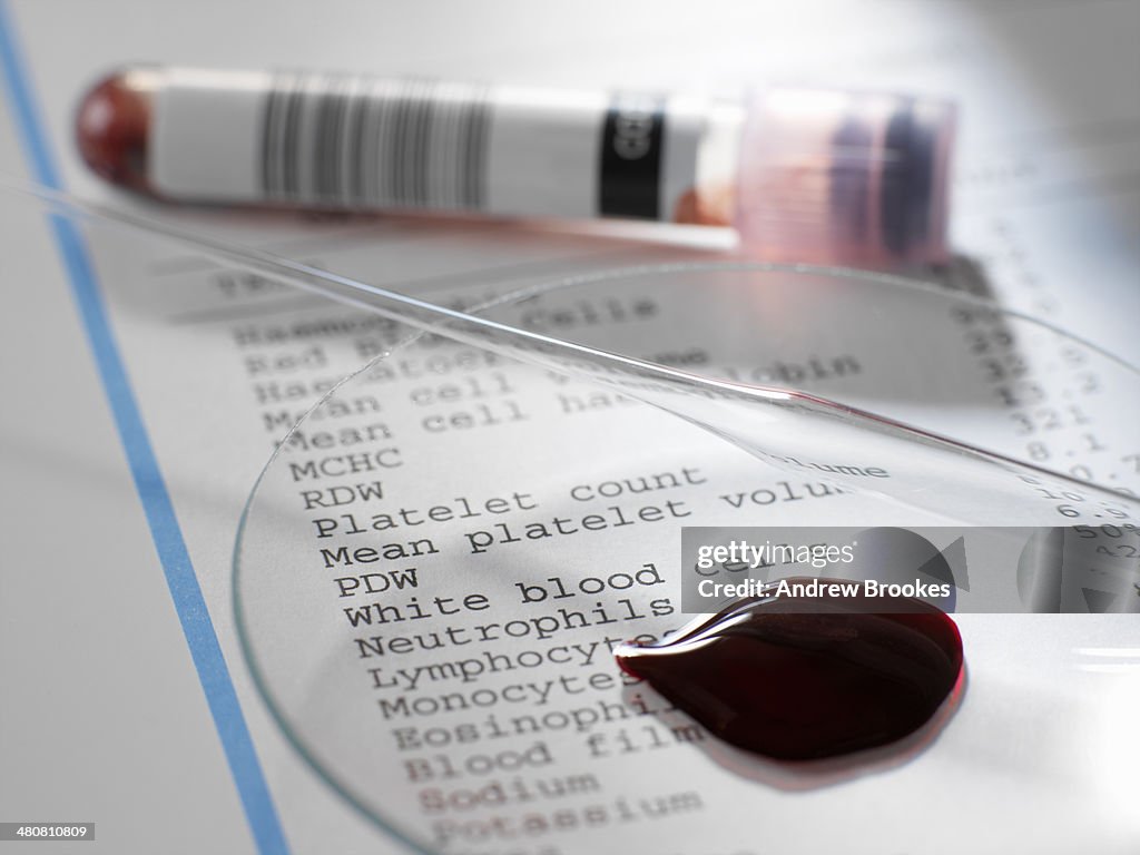 Blood sample with results of clinical analysis of the blood component