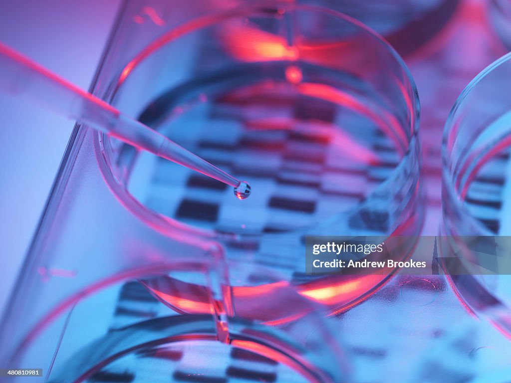Pipetting sample into tray for DNA testing