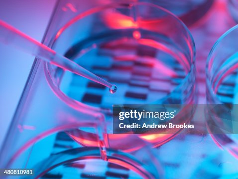 Pipetting sample into tray for DNA testing Pipetting sample into tray for DNA testing