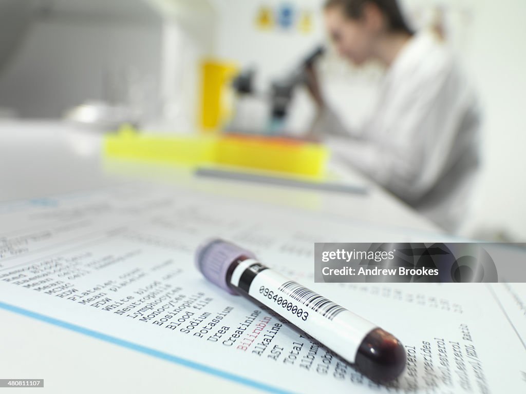 Blood tube sitting on blood results with technician at microscope in lab