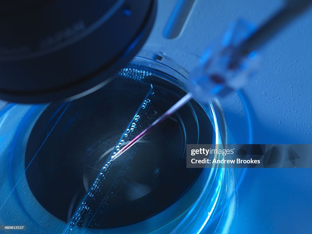 Nuclear transfer, Stem cells made from the cell nucleus