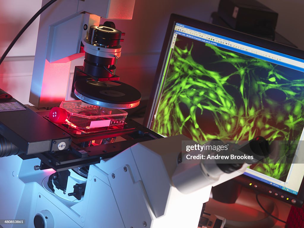 Inverted microscope viewing stem cells in flask with display of a fluorescent labeled cells